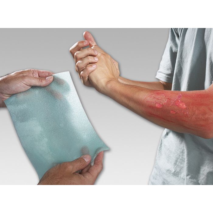 95750 Hydrogel Burnfree, 20 x 3,5 g